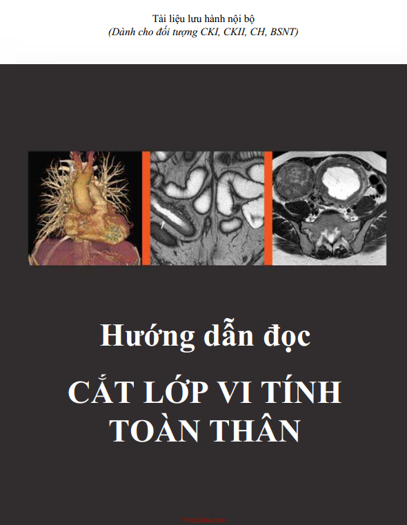 [Sách dịch] Hướng dẫn đọc cắt lớp vi tính toàn thân